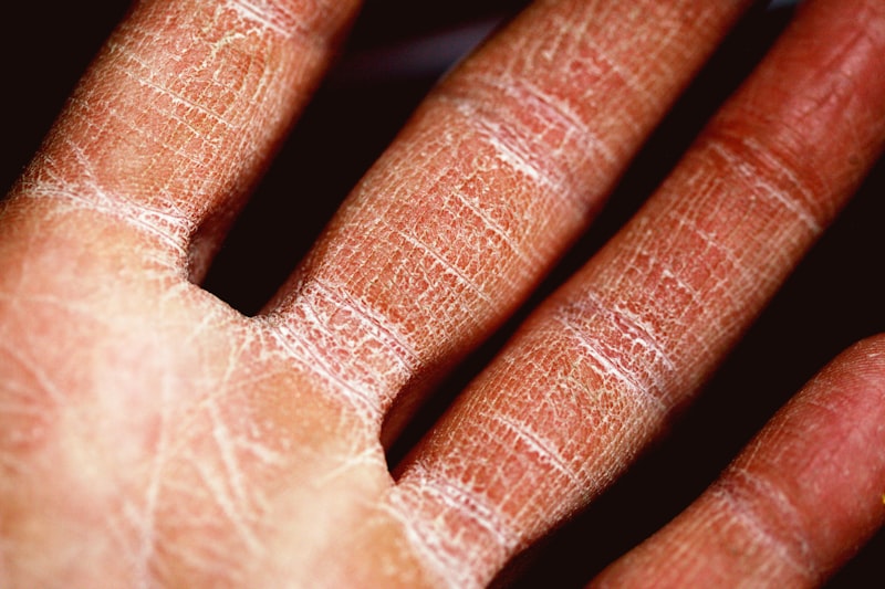 Contact dermatitis patch testing
